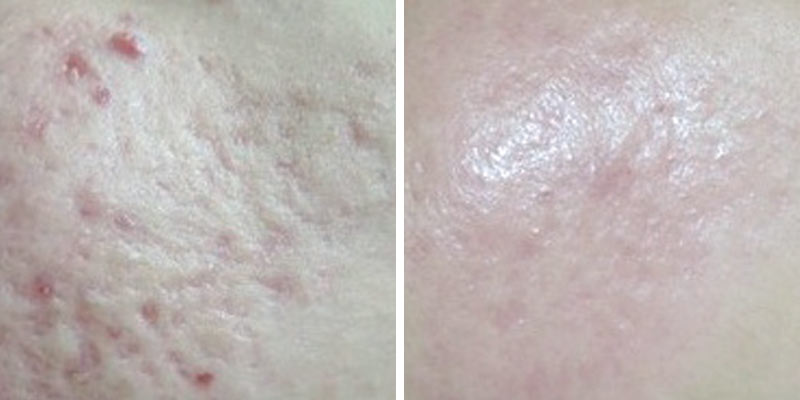 before-after-04