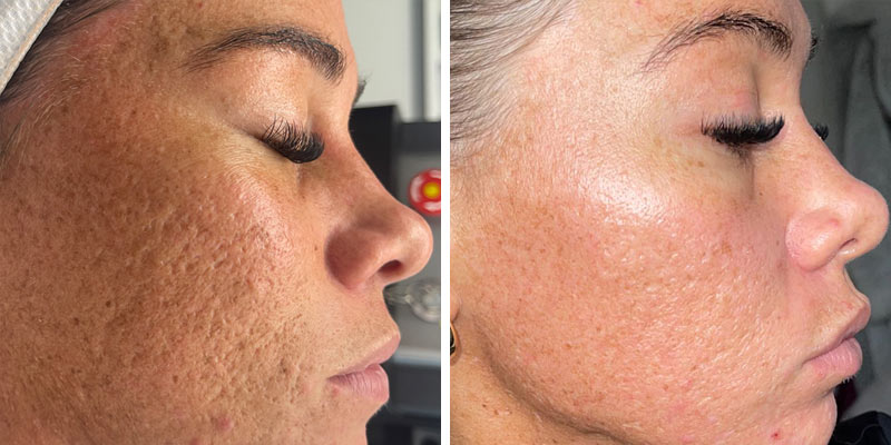 before-after-01