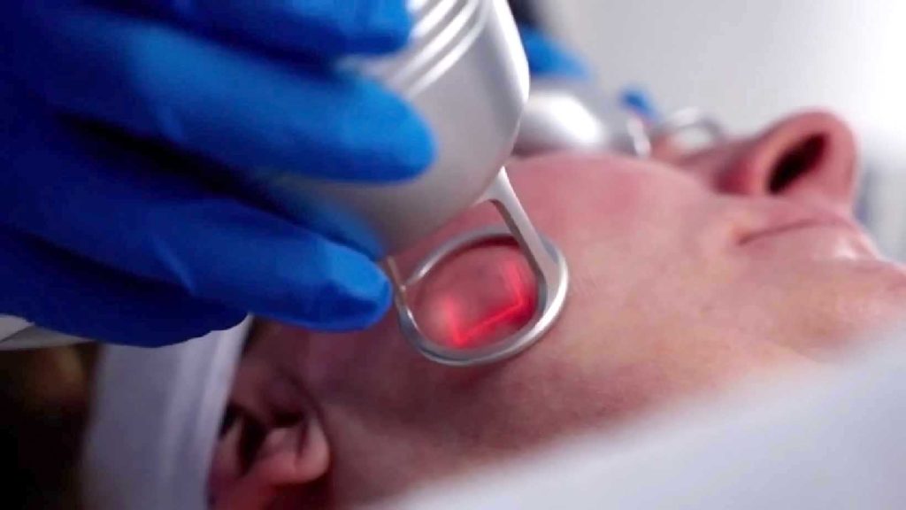 10 Benefits of CO2 Laser Treatments
