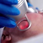 CO2-Laser-Benefits